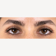 barbie · Both eyes