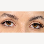 peony · Both eyes